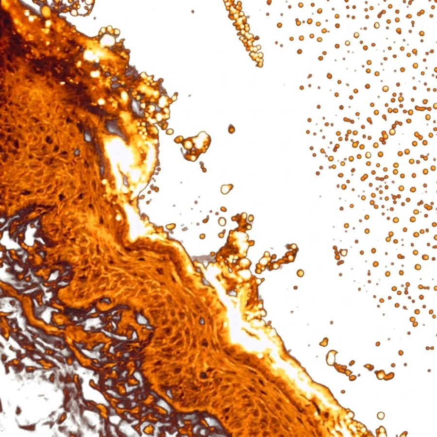 Skin biopsy image showing rhodamine-filled SmartSorb spheres penetrating the stratum corneum and epidermis