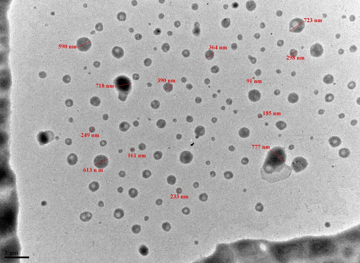 Transmission electron microscopy image of SmartSorb nanoparticles with measured particle sizes annotated, ranging from 91 to 777 nanometers
